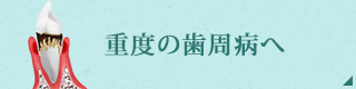 重度の歯周病へ