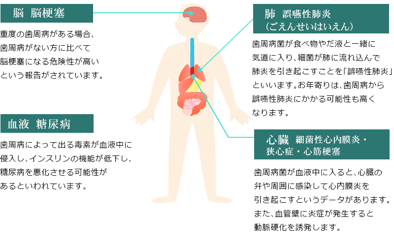 全身疾患の危険性